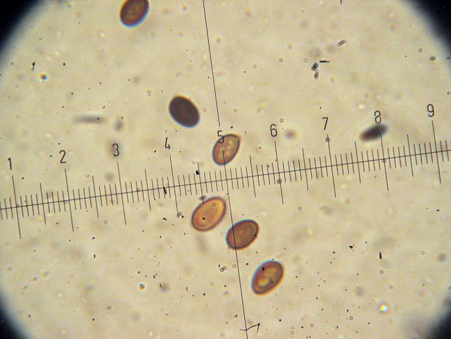 Agaricus GM1277 (moellerianus??)